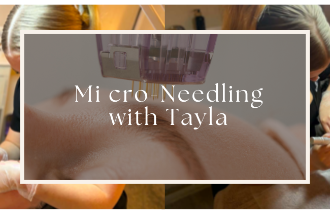 Micro-needling with tayla