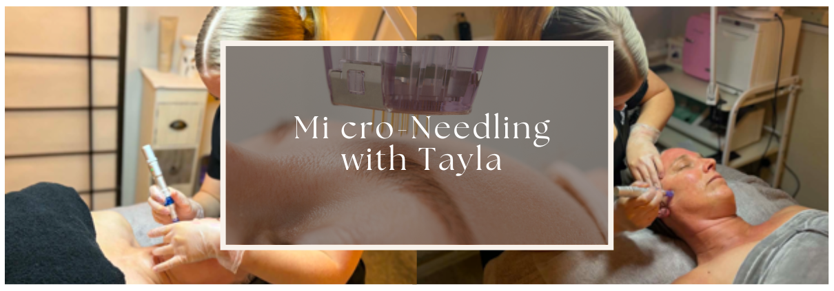 Micro-needling with tayla