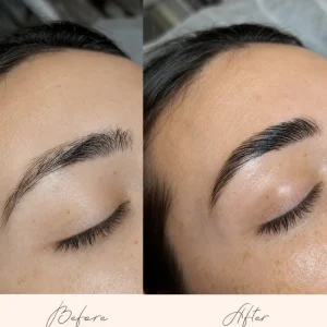 Brow Treatments - Before & After