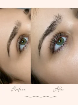 Brow Treatments - Before & After