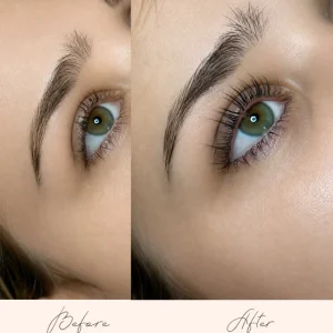 Brow Treatments - Before & After