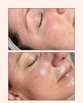 Medik8 Facial Medik8 Facial