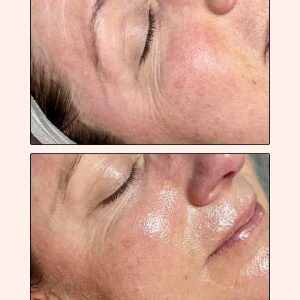 Medik8 Facial
