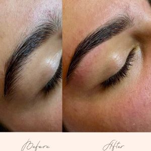 Brow Treatments - Before & After