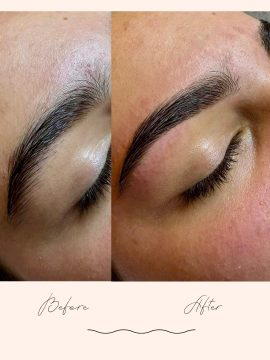Brow Treatments - Before & After