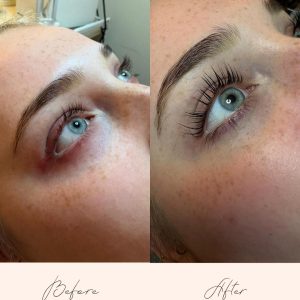 Brow Treatments - Before & After