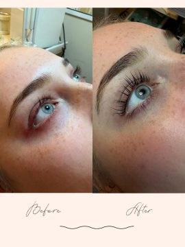 Brow Treatments - Before & After