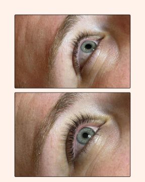 Brow & Lash Combo - Before & After
