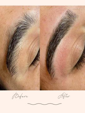 Brow Treatments - Before & After