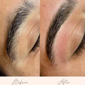 Brow Treatments - Before & After