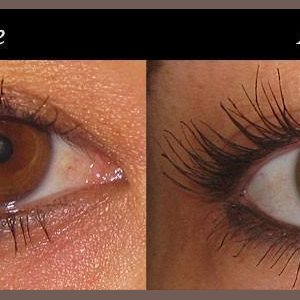 lilash-before-after-2